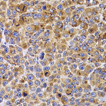 Immunohistochemistry - UBE2R2 antibody (144-07373)