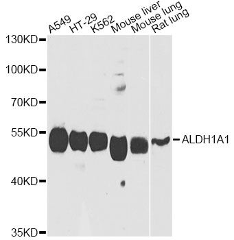 Western blot - ALDH1A1 antibody (144-01802)