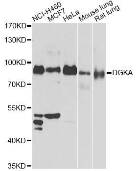 Western blot - DGKA antibody (144-60536)