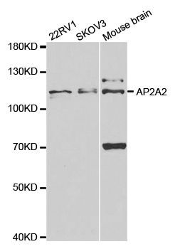 Western blot - AP2A2 antibody (144-05391)