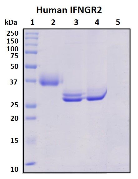 SDS-PAGE