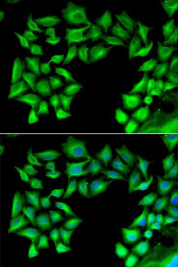 Immunofluorescence - TIMP4 antibody (144-06416)