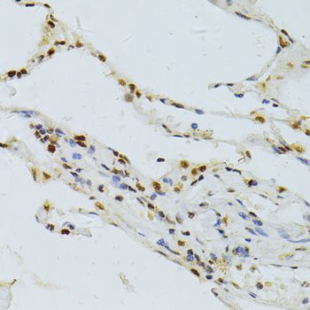 Immunohistochemistry - ALYREF antibody (144-06010)