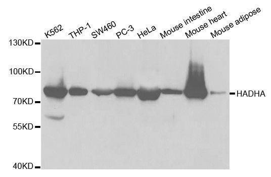 Western blot - [KO Validated] HADHA Polyclonal Antibody (144-05346)