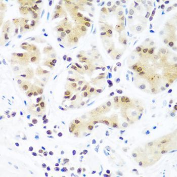 Immunohistochemistry - AGO2 antibody (144-06023)