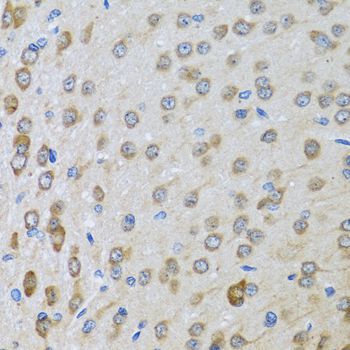 Immunohistochemistry - BTD antibody (144-06284)