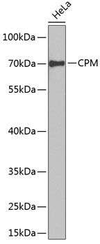 Western blot