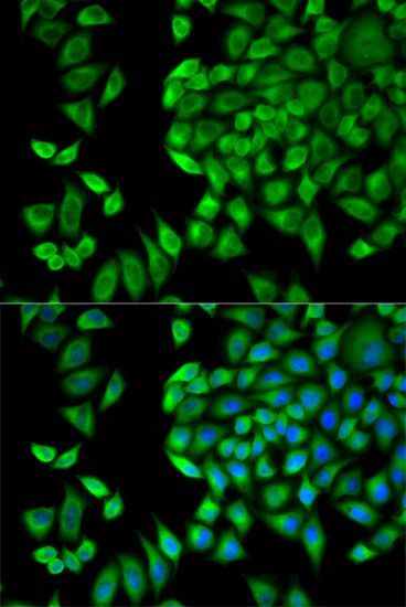 Immunofluorescence - WNK1 antibody (144-02569)