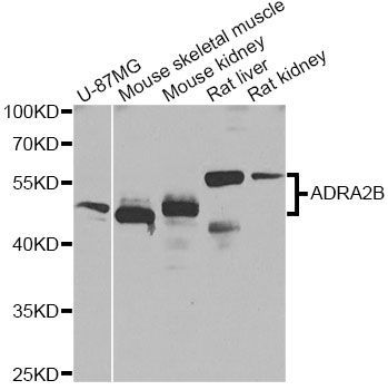 Western blot - ADRA2B Antibody (144-08535)
