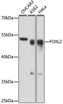 Western blot