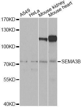 Western blot - SEMA3B Antibody (144-07004)