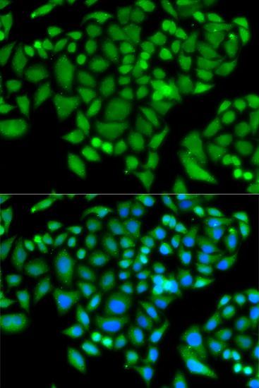 Immunofluorescence - CHAF1B antibody (144-06259)