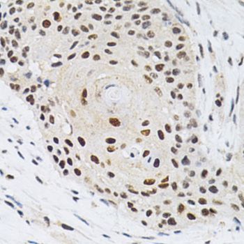 Immunohistochemistry - KPNA4 Antibody (144-02026)