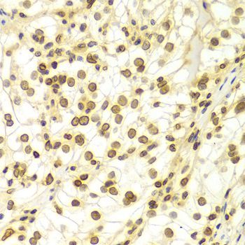 Immunohistochemistry - Lamin A/C Polyclonal Antibody (144-00249)