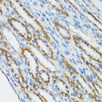 Immunohistochemistry - CTNNA1 Polyclonal Antibody (144-05635)