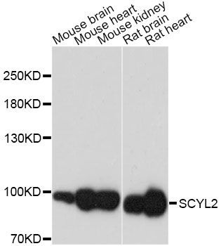 Western blot - SCYL2 antibody (144-60224)