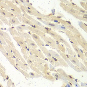 Immunohistochemistry - PSME1 Polyclonal Antibody (144-05358)