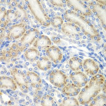 Immunohistochemistry - ASPSCR1 Polyclonal Antibody (144-07481)