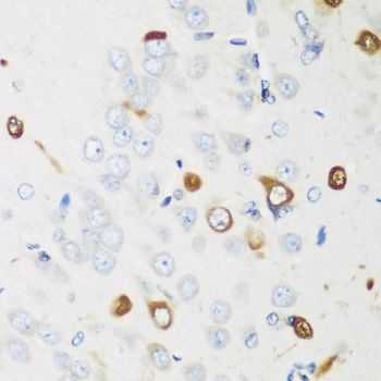 Immunohistochemistry - ELAVL2 antibody (144-05918)