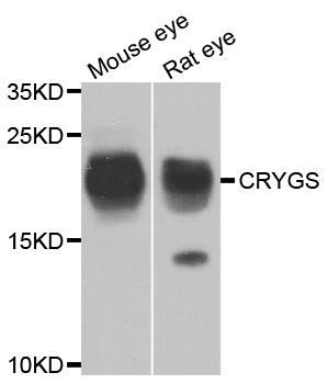 Western blot - CRYGS antibody (144-07888)