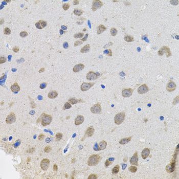 Immunohistochemistry - VEPH1 antibody (144-08510)