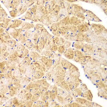 Immunohistochemistry - ACTN1 antibody (144-01160)