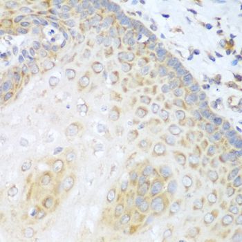 Immunohistochemistry - PRKCD Polyclonal Antibody (144-00471)