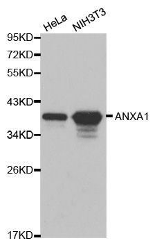 Western blot - [KO Validated] ANXA1 Polyclonal Antibody (144-01118)