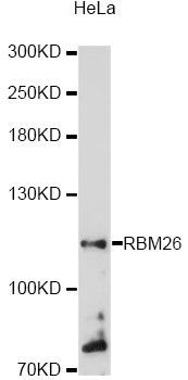 Western blot - RBM26 antibody (144-60198)