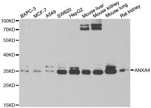 Western blot - ANXA4 antibody (144-06280)