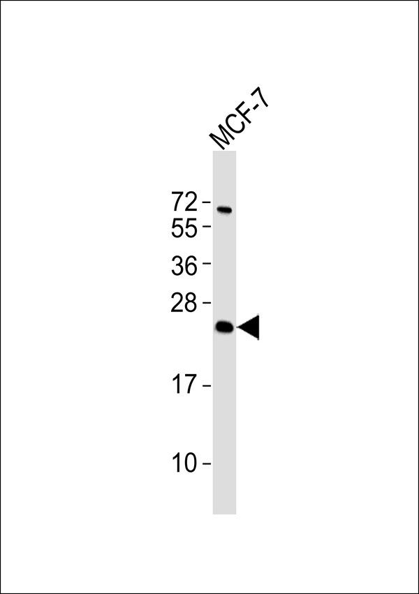 WB
