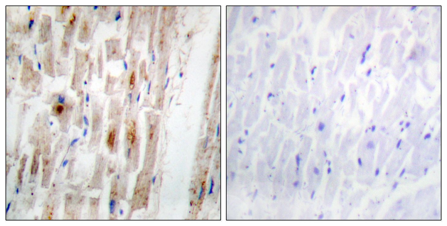 IHC