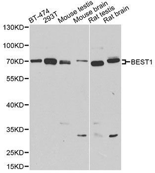 Western blot - BEST1 antibody (144-03022)