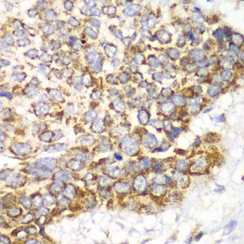 Immunohistochemistry - TFAM Polyclonal Antibody (144-013552)