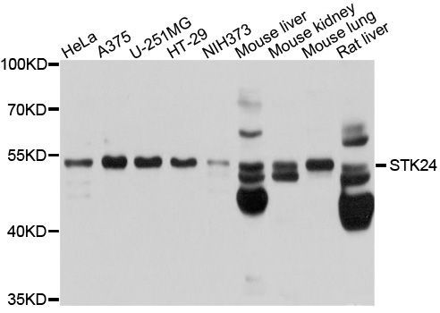 Western blot - STK24 Polyclonal Antibody (144-10576)