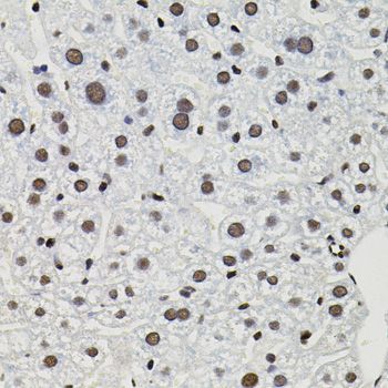 Immunohistochemistry - GTF2I antibody (144-07898)