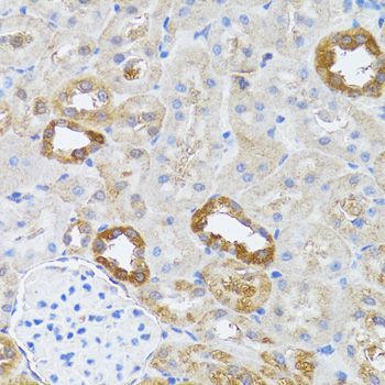 Immunohistochemistry - RNASEL antibody (144-09840)
