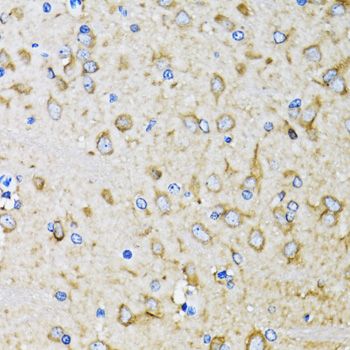 Immunohistochemistry - MAP1LC3B Polyclonal Antibody (144-07198)