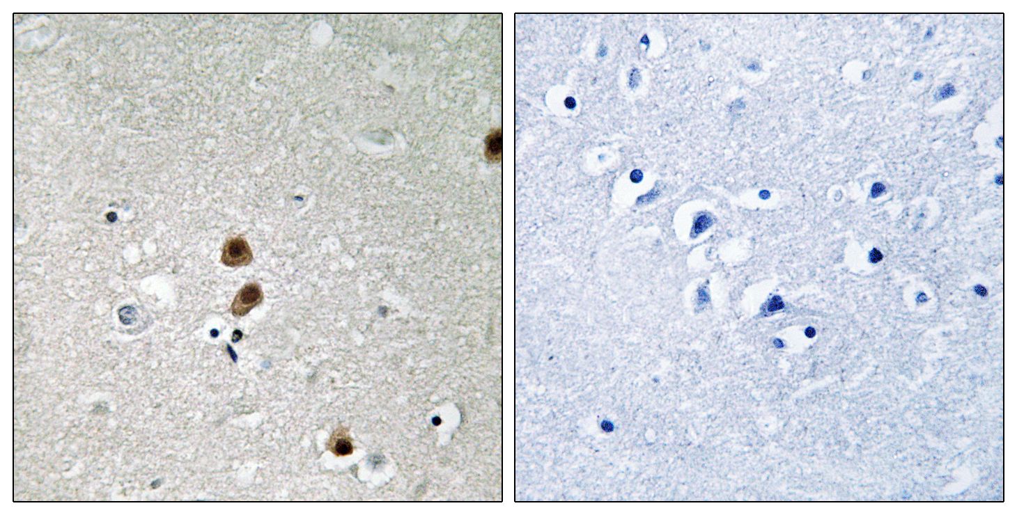 IHC