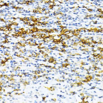 Immunohistochemistry - SNRNP70 antibody (144-06065)