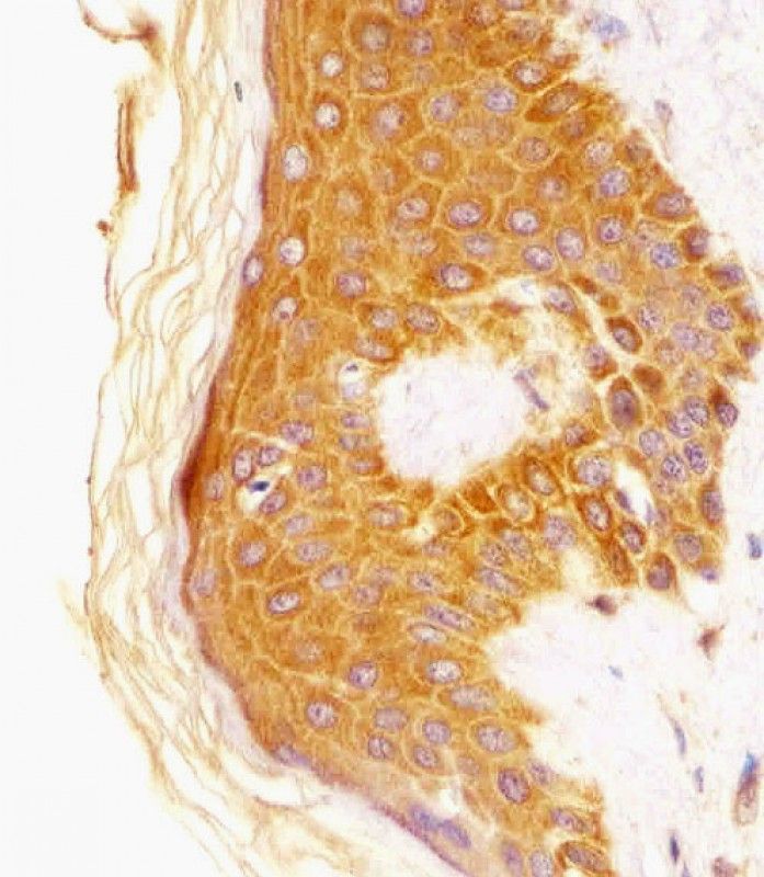 IHC-P