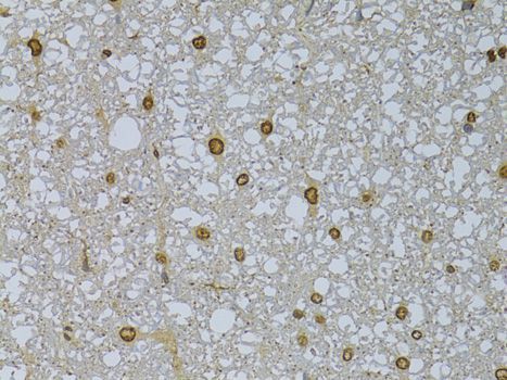 Immunohistochemistry - HDGFRP3 antibody (144-08815)