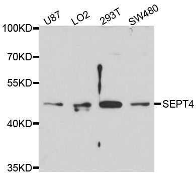 Western blot - SEPT4 Polyclonal Antibody (144-010238)