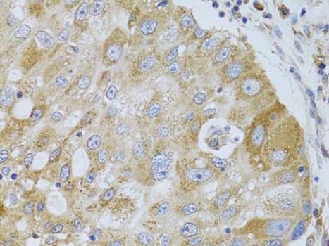 Immunohistochemistry - [KO Validated] HDAC8 Polyclonal Antibody (144-05829)