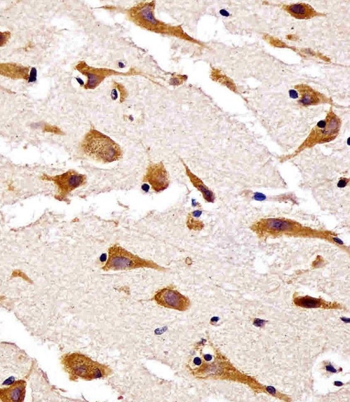 IHC-P