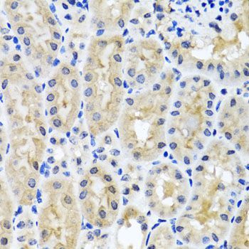 Immunohistochemistry - SNAP29 antibody (144-04290)