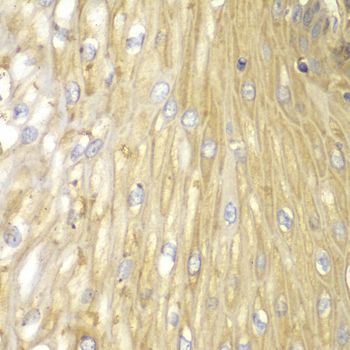 Immunohistochemistry - PPP2R2A antibody (144-02185)