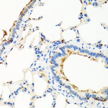 Immunohistochemistry - RGS5 antibody (144-07015)