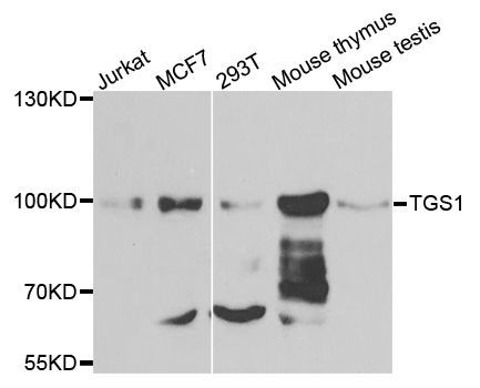 Western blot - TGS1 antibody (144-07848)