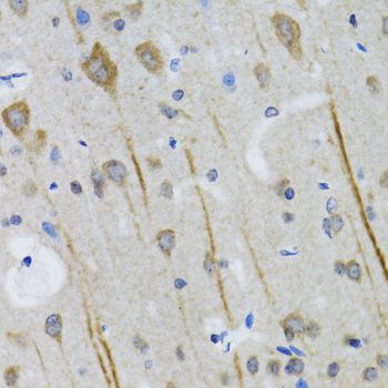 Immunohistochemistry - HTR3A antibody (144-05647)